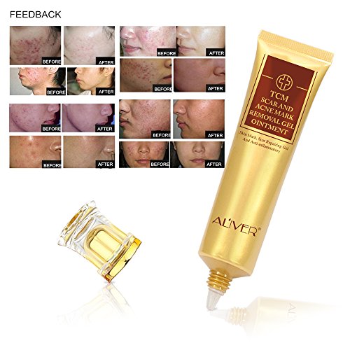 2 Pack TCM Scar and Acne Marks Removal Gel, Antiinflammatory