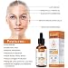 Suero de Vitamina C para Rostro - Suero Facial Puro con 20%...