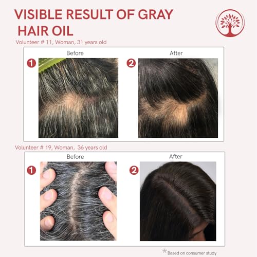 Image of Oil for Greys (200 Ml) - Helps Stop Greying & Brings Back Natural Black Hair | With all 100% Natural Ingredients including Apricot, Moroccan Argan, Jojoba