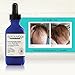 Éprouvage Reviving Scalp Serum – For Thicker, Fuller Hair – Thinning Hair, Hair Loss Treatment – 2 Fl. Oz.