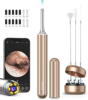 Amazon.co.jp: 耳かき BEBIRD X17 Pro 耳鏡 イヤースコープ カメラ 800