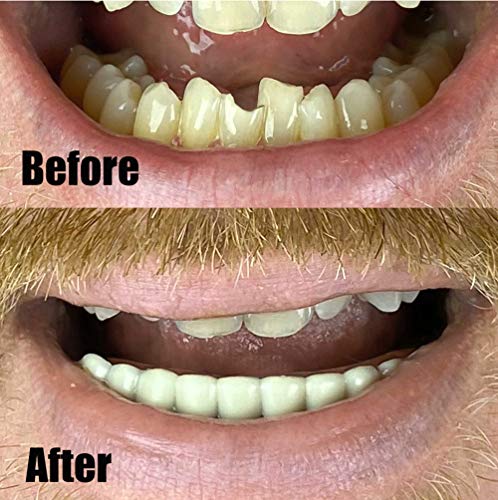 Instant Smile Comfort Fit Flexible Lower Teeth #TOP2