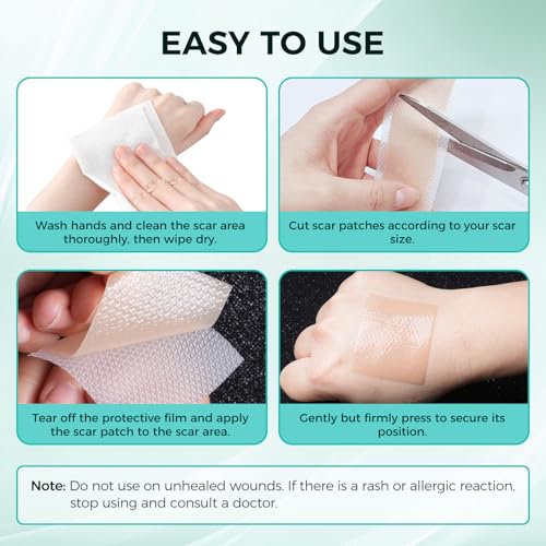 Cioxsoio Cerotti Silicone Cicatrici 4X300Cm, Tagliabile E Riutilizzabile Cerotto Silicone Per Cicatrici - 4