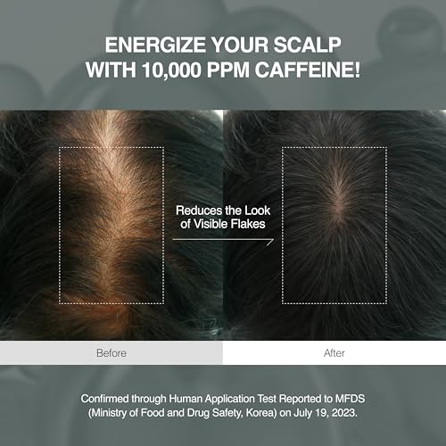 Image of Korean Scalpy Hair Growth Serum for Women for Hair Loss & Thinning - Cooling & Refreshing Korean Hair Care For Oily, Lightweight, Treatment, Frizz Ease Serum, Hair loss, Anti Frizz, Hair Mask