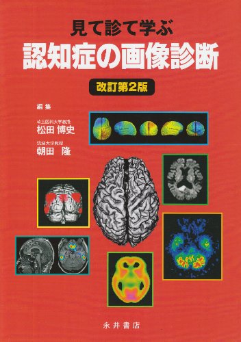 スマホ 無料電子書籍 認知症の画像診断―見て診て学ぶ バイ