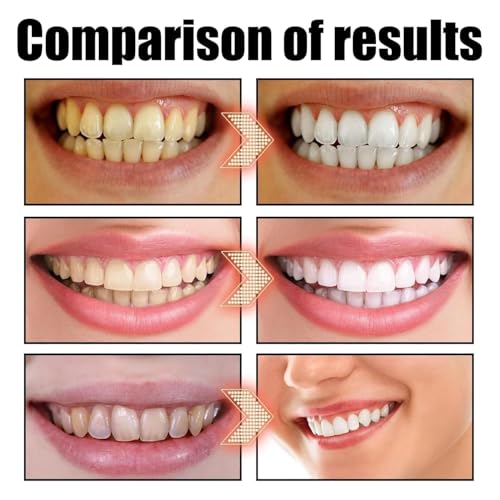 Kokosnuss-Mundspülung, Ourlyard Kokosöl-Mundspülung mit Ätherischem Öl, Kokosöl-Pulling für Zähne, Kokosöl-Mundspülung, Kokosöl-Pulling, Frischer Atem, Aufhellende Mundspülung (3) – Bild 7