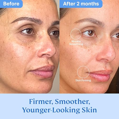 HYDRONOVA Total Rewind Sculpting Serum 1 fl oz | Line-Smoothing, Dark Spot Corrector | Vitamin C, Niacinamide, Kojic Acid, Peptides | Radiant Glow, Balanced Complexion | AM Formula