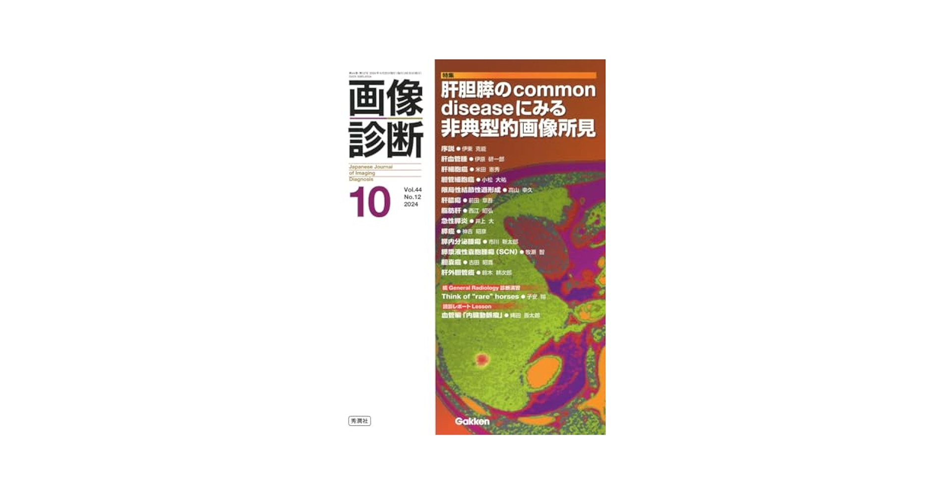 肝画像診断テキスト [単行本] 大友邦 肝画像診断テキスト [単行本] 大友邦 画像診断シークレット