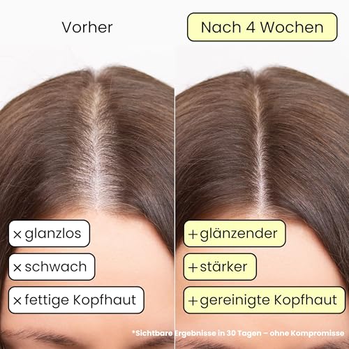 Enooso - Bio-Shampoo Gegen Haarausfall, Stärkt Mit Rosmarinöl, Verdünnt Mit Reinigendem Rizinusöl, Für Fettiges Haar, 100% Natürliches und Veganes Festes Shampoo - 130g