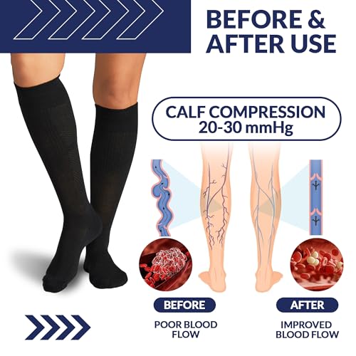Image of SB SOX Compression Socks for Men & Women (20-30mmHg) - Best Compression Socks for Travel, Medical, Sports, Wide Calf Fit, and Daily Wear