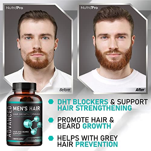 Hair Growth Vitamins For Men - Anti Hair Loss Pills. Regrow Hair & Beard Growth Supplement For Volumize, Thicker Hair.Stop Hair Loss And Thinning Hair With Biotin & Saw Palmetto Hair Vitamins.120 Caps - Image 4