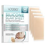 ✔️【PARCHE DE SILICONA PARA CICATRIZ - 4PCS】- Los parches de silicona ayudan a mejorar más rápidamente la cicatriz y proporcionan una barrera física entre la cicatriz y el entorno externo para mantener la cicatriz húmeda y limpia, lo que ayuda a mejorar el estado general de la cicatriz.