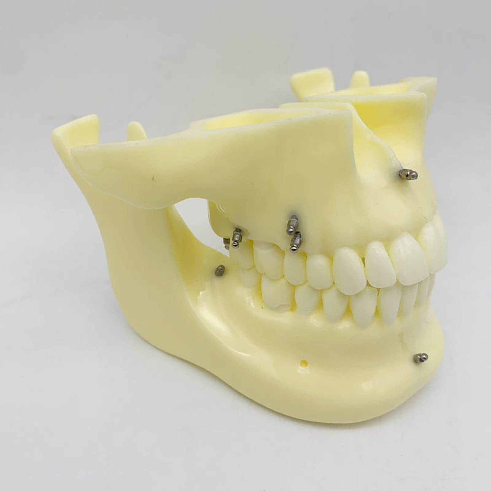 Modello dentale di base per la formazione sull'implantologia, a scopo didattico per studi odontoiatrici e ricerca medica.