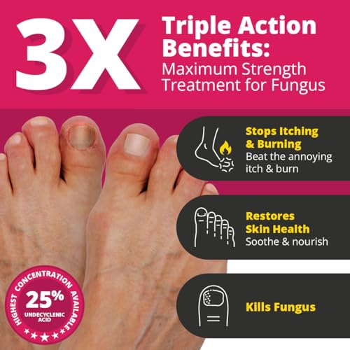 image for Better Nail - Treatment for Fungus Under & Around the Nail - Maximum S