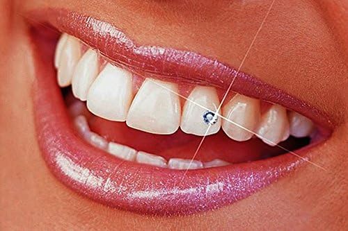 Tooth Gems Crystal Kit