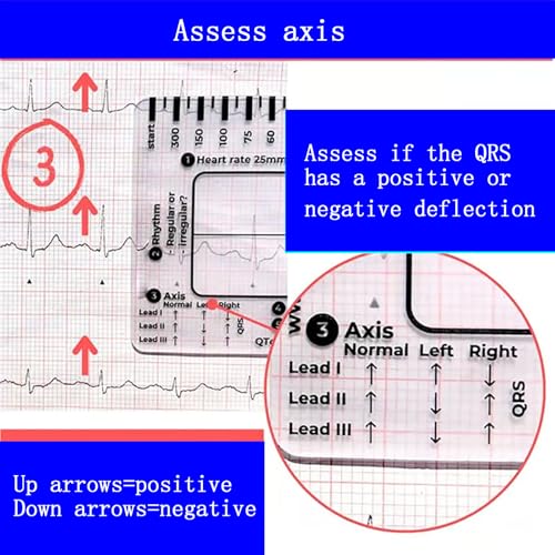Reglas de ECG de 7 pasos para el bolsillo de la bata en pases de guardia 5