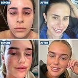 Grahams Natural Face & Eyelid Eczema Cream - Face Cream for Eczema, Dermatitis & Itch Relief - with Colloidal Oatmeal for Dry Skin, Redness & Inflammation | Hypoallergenic & Steroid-Free (1 x 50 g) - Image 6