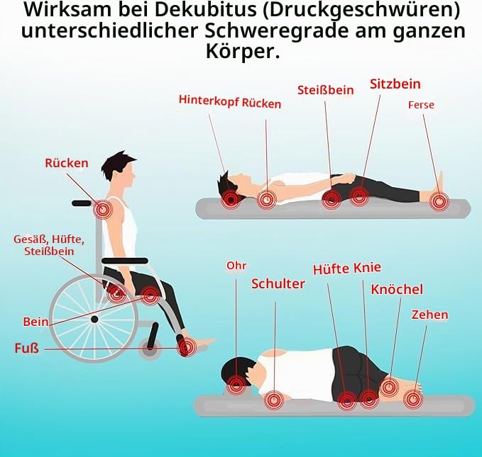 ishancare® Dekubitus-Creme - Schnell & sicher natürlich heilende Dekubitus-Creme, Dekubitus-Wundpflege-Heilsalbe, Behandlung von Dekubitus Druckgeschwüren Diabetiker-Geschwüren Wunden Verbrennungen un