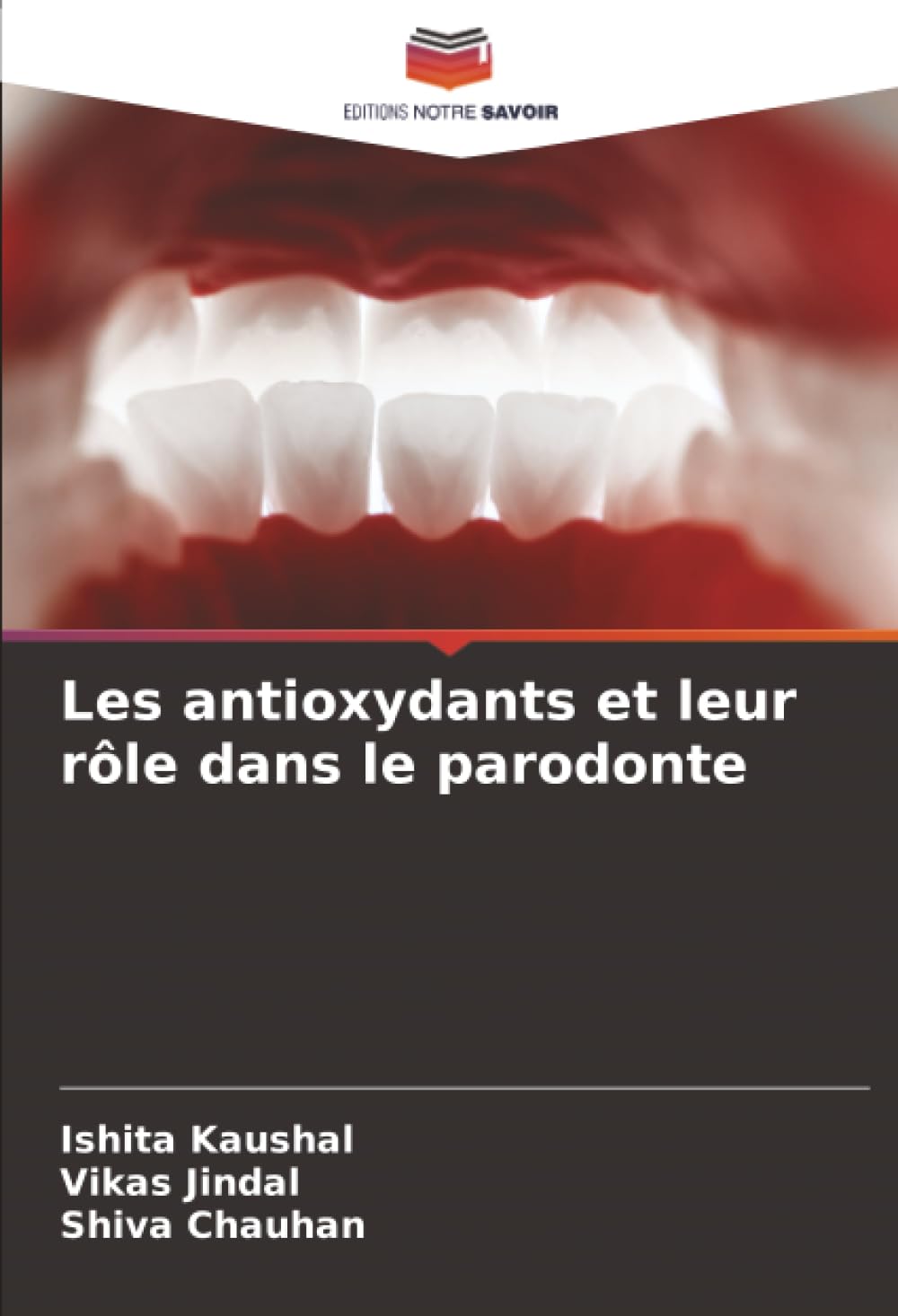 Les antioxydants et leur rôle dans le parodonte