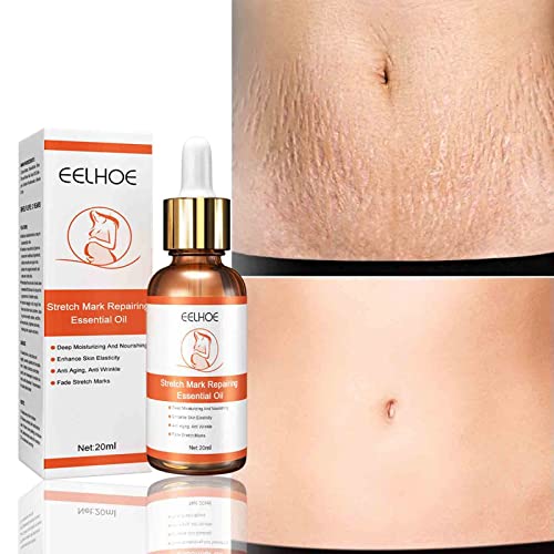 Stretch Mark Repair Essential Oil, Scar Cream Removal Cream, Oil for Stretch Marks Prevent, Fade Stretch Marks 20ML, Stretch Mark Treatment Pregnant Women
