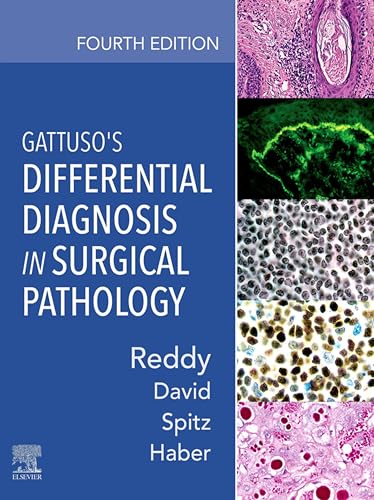  Gattuso\'s Differential Diagnosis in Surgical Pathology (English Edition)