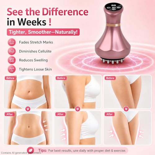 Image of 4-in-1 Lymphatic Drainage Massager - Anti-Cellulite Message Tool with Heating /Vibration /Light Therapy, Full Body Pain Relief & Skin Tightening，Cordless Handheld for Sciatica