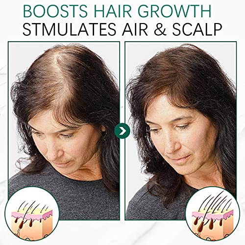 Scaling Women Exfoliating Shampoo For Scalp, Hair Oil Control, Nourishment Scalp Care Scrub, Stimulate Hair Growth, For Hair Density, Repair Damaged Hair. #TOP4