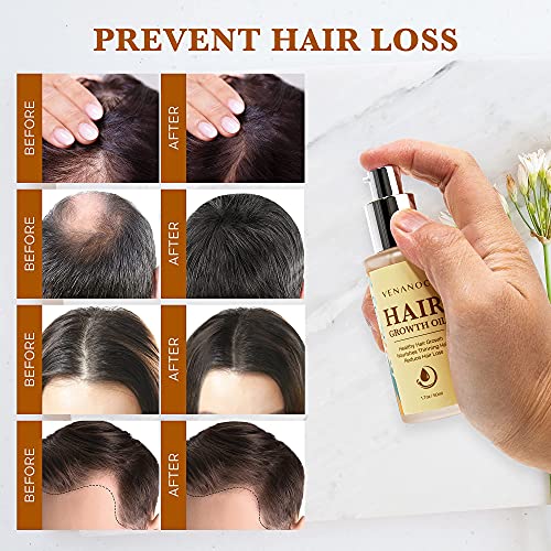 Venanoci Hair Growth Oil - Effective For Hair Growth, Hair Loss Liquid, Hair Growth Formula, Hair Care Serum, For Thicker & Healthier Hair, Reduces Hair Shedding & Thinning - Thumbnail 2