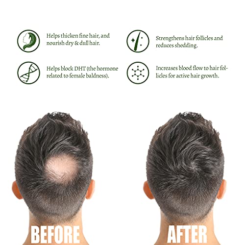 Ativo Wellness Sangre De Grado Hair Growth Shampoo With Rosemary And Nettle Extract-500Ml #TOP3