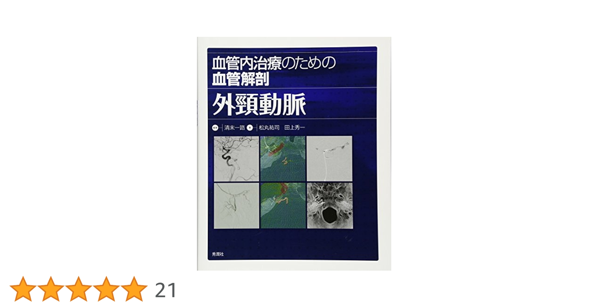 血管内治療にかかわる医師必携 硬膜動静脈瘻のすべて 硬膜動静脈瘻塞栓術ハンドブック | 滝 和郎 |本 | 通販 | Amazon