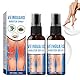 Timilk veinguard kräuterspray, Vanguard Herbal Spray, Professional vanguard kräuterspray,Varicose Veins Sprays for Legs, Verbessern Sie das Aussehen der Beine und die Durchblutung(2 Stück x 30 ml)