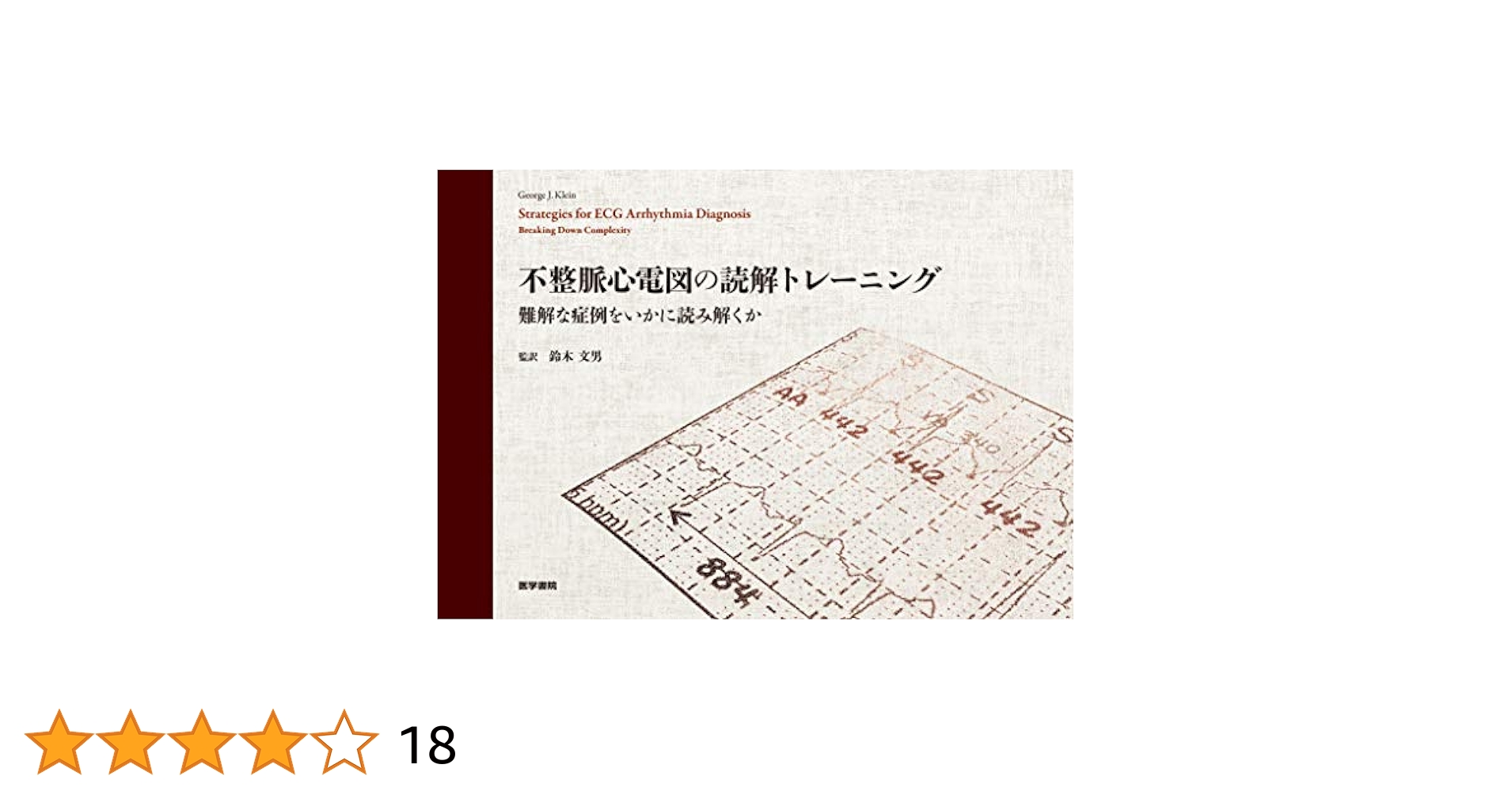 不整脈心電図の読解トレーニング 難解な症例をいかに読み解くか 不整脈心電図の読解トレーニング: 難解な症例をいかに読み解くか