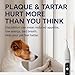 SIRGAWAIN Plaque Remover for Teeth - Pet Ultrasonic Cleaner - Teeth Cleaning Kit for Tartar and Stains - Suitable for Dogs and Cats, 3 Modes, and 4 Replaceable Heads (White)