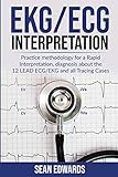 EKG/ECG Interpretation: Practice Methodology for a Rapid Interpretation, Diagnosis About the 12 LEAD ECG/EKG and all Tracing Cases