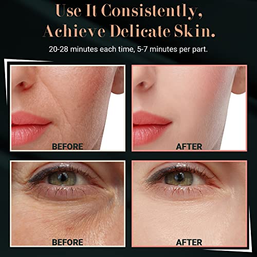 Red Light Therapy For Face - Uupas Led Infrared Red Facial Light Therapy Device #TOP4