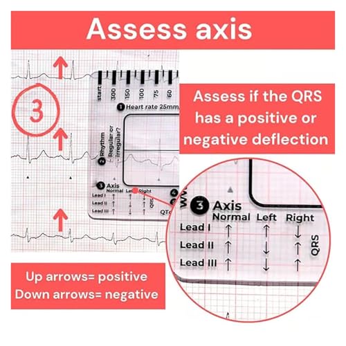 Règle ECG pour interpréter l'intervalle PR facilement sans erreur de lecture - 5