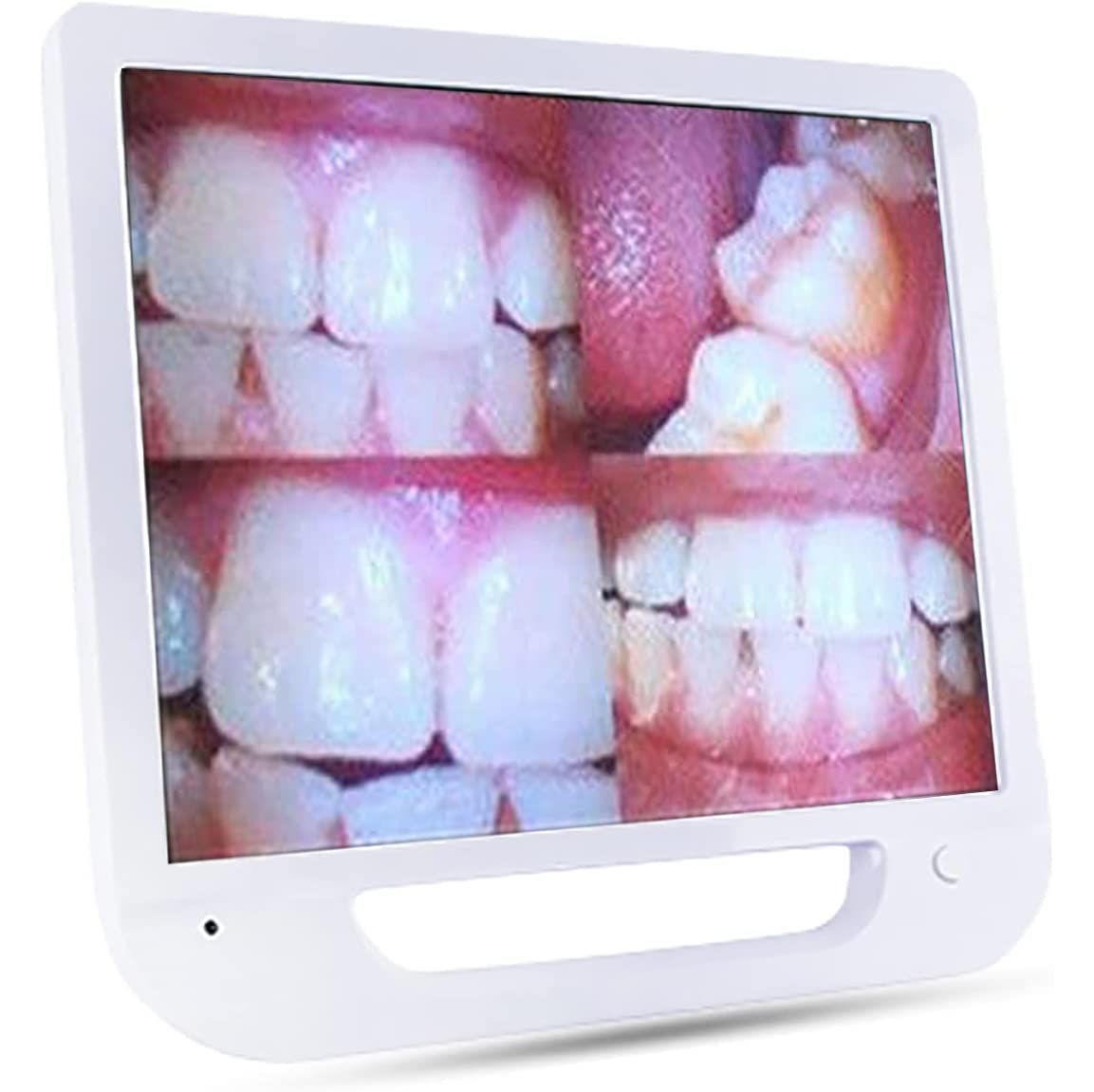 Telecamera Intraorale Dentale, Telecamera Endoscopica Medica Telecamera Intraorale Dentale, VGA con Monitor da 17 Pollici/Scanner Intraorale Digitale CMOS Odontoiatria