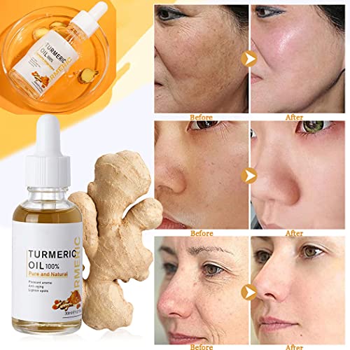 Turmeric Dark Spot Corrector Serum,Natural Turmeric Acne Dark Spot Remover For Body And Face Serum Repair Facial Essence,Melasma Corrector Facial Serum Skin Care Moisturizing Serum Rich Ginger Root Extract(2Pcs) #TOP2