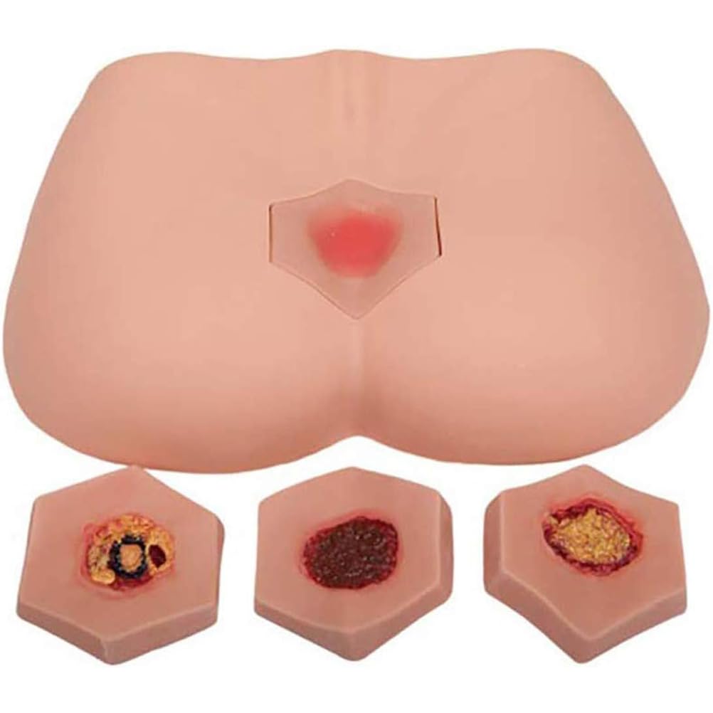 Modello di cura dell'ulcera da decubito - 4 fasi di piaghe da decubito simulatore di piaghe da decubito per formazione infermieristica e insegnamento - formazione medica decubito cura delle ferite
