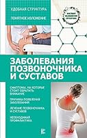 Zabolevaniia pozvonochnika i sustavov 5171050163 Book Cover