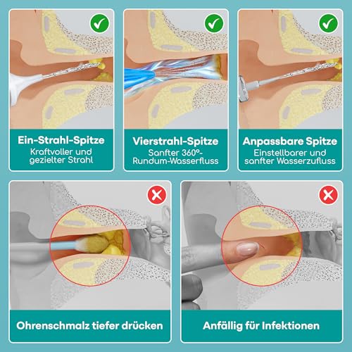 Ohrenreiniger zur Entfernung von Ohrenschmalz, Ohrreiniger mit 300 ml Flasche + 10ml Olivenöl Ohrentropfen, Komplettes Ohrspülungsset von Medi Grade
