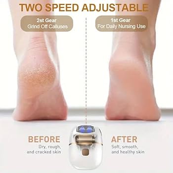 Buy JICOOT Electric callus remover for feet - Rechargeable