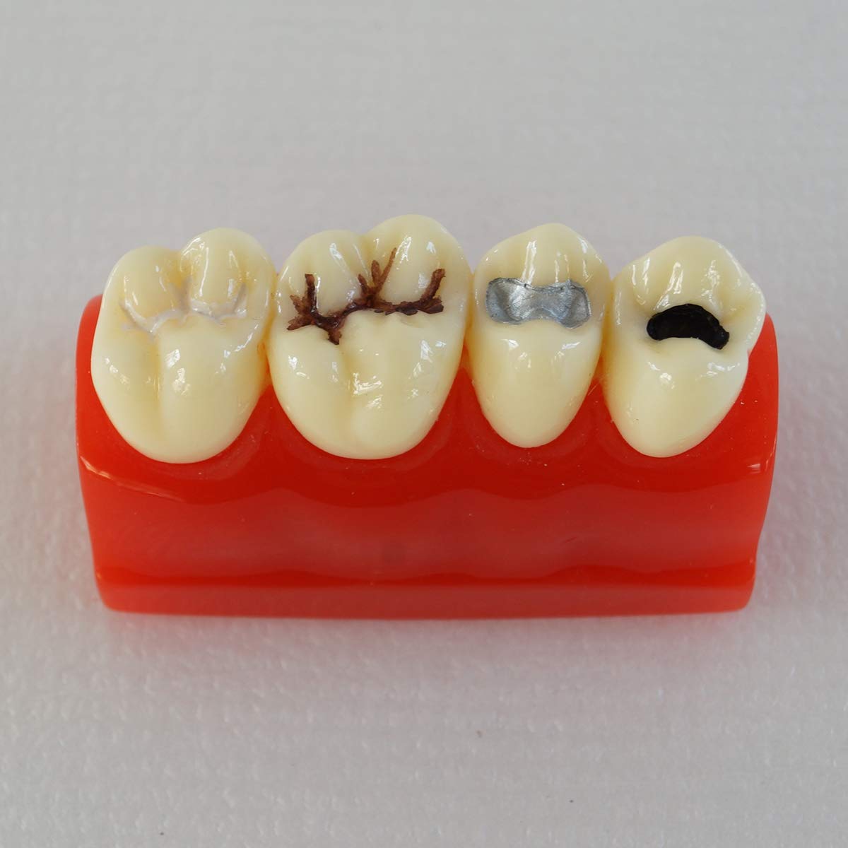 Modello di denti dentali per allenamento orale, chiusura a fessura e scanalatura, strumento educativo per anatomia umana, studio medico e simulatore di pratica
