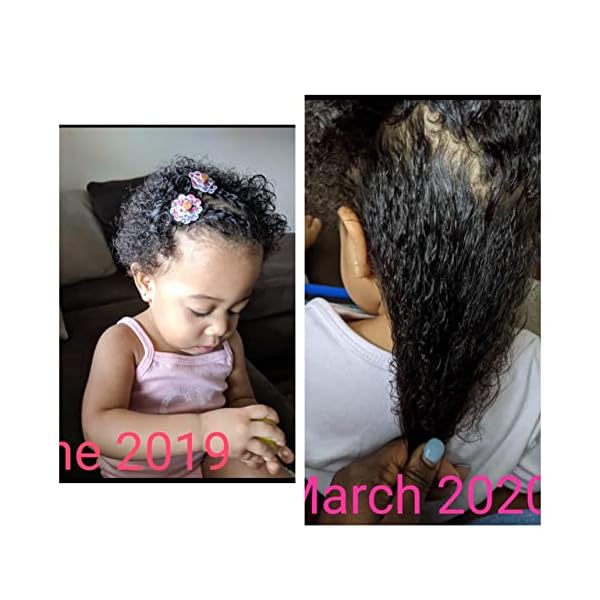 J'Organic Solutions Kids Super Moisturizing, Hydrating healthy hair Growth set – Bild 8