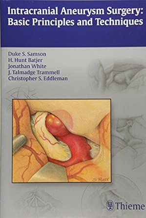 Intracranial Aneurysm Surgery: Basic Principles and Techniques book cover