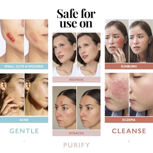 Image of Aquia Hypochlorous Acid Spray for Face and Skin; Facial Cleanser | 8oz Face Mist Hypochlorous Acid Spray for Skin, Acne, Rash, Eczema, Wound | Antimicrobial Facial Cleanser Acne Sprays; Purple 8oz