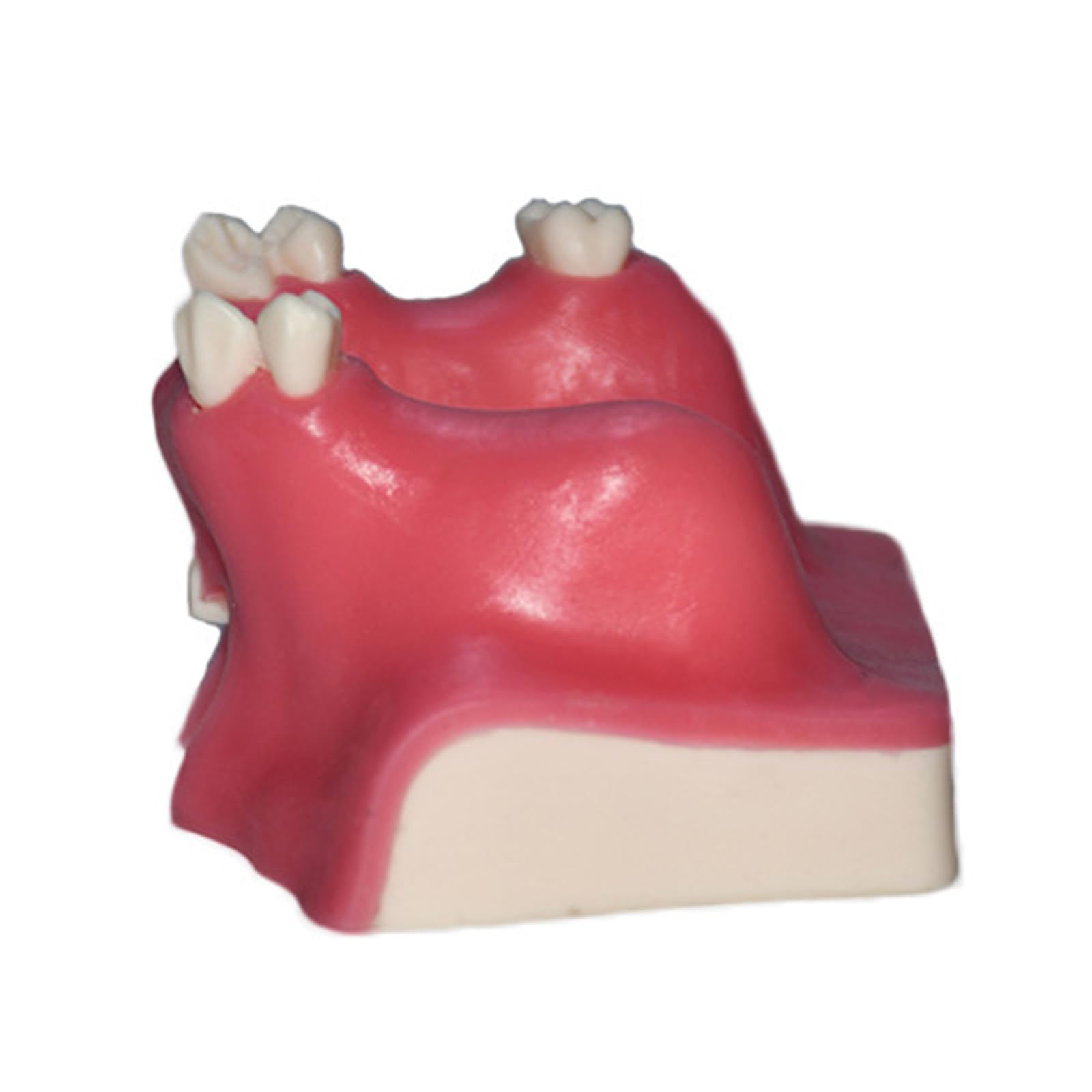 Modello di impianto Dentale - Modello di impianto mandibolare Medico e odontoiatrico - per Studio didattico Displaymedical Model，A9 8cm