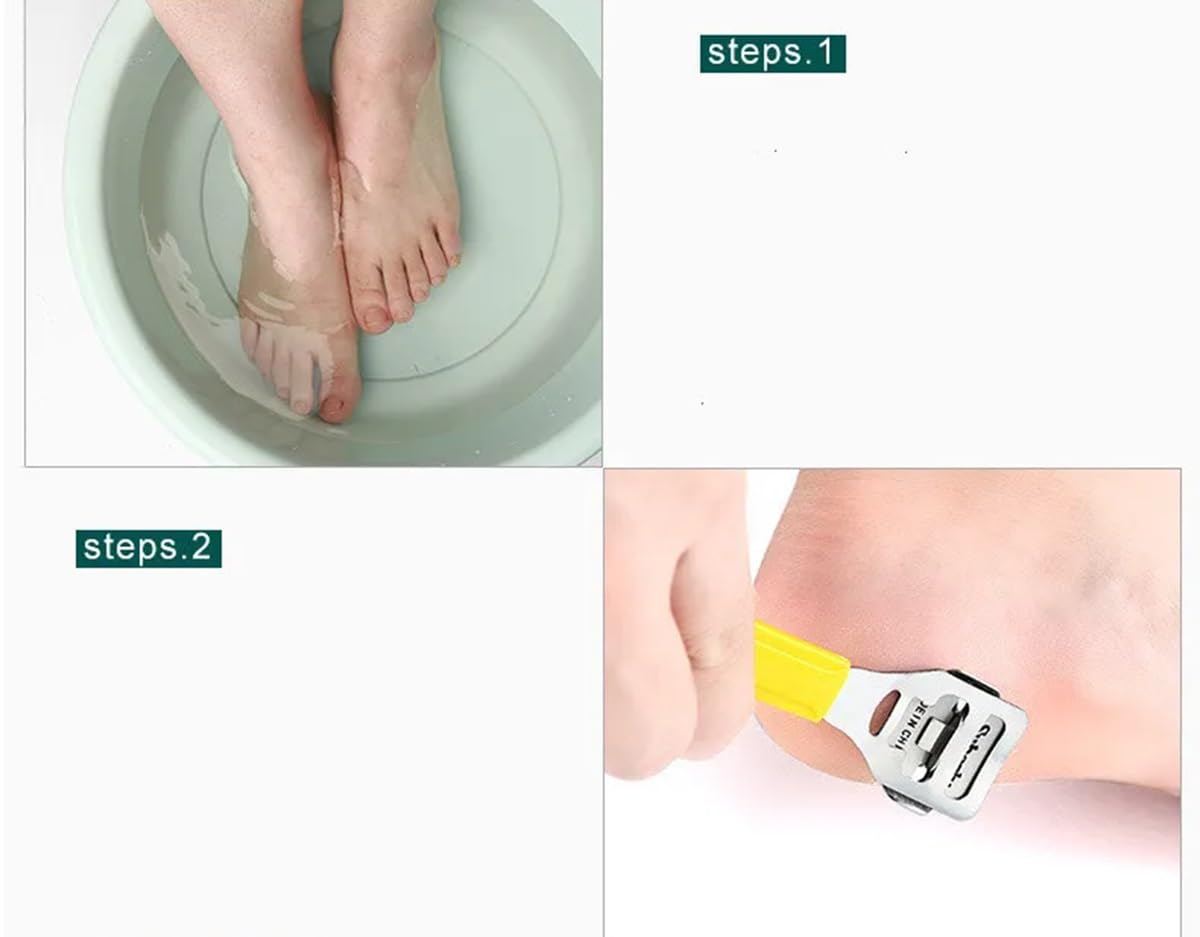 Keli Pedicure Tools for Feet - 8 in 1 Pedicure Kit | Foot Scrubber for Dead Skin, Callus Remover, Foot Scraper, Foot File, Pitchfork, Filer for Nail Repair (Multicolor) 1