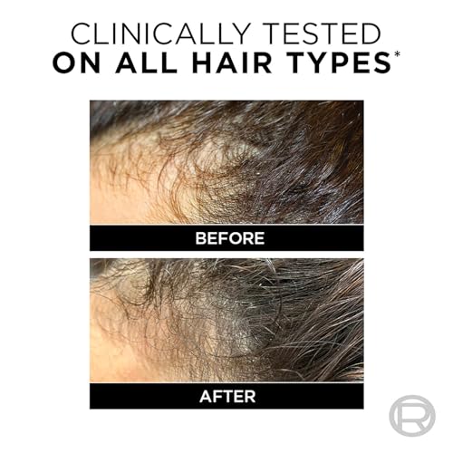 L'Oreal Paris Store L'Oreal Paris Fall Resist 3X Anti-Hairfall - Image 6