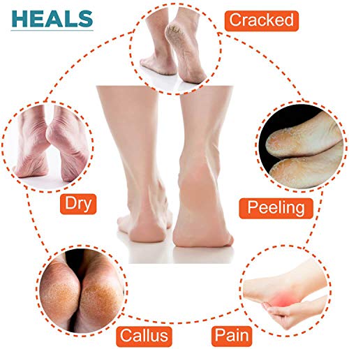Image of IZZORI Silicone Gel Heel Socks for Dry Hard Cracked Heel Repair Pad, Swelling & Pain Relief, Cushion Support, Foot Care, Ankle Protection, Plantar Fasciitis for Men and Women (Free Size, Blue, 1 Pair)